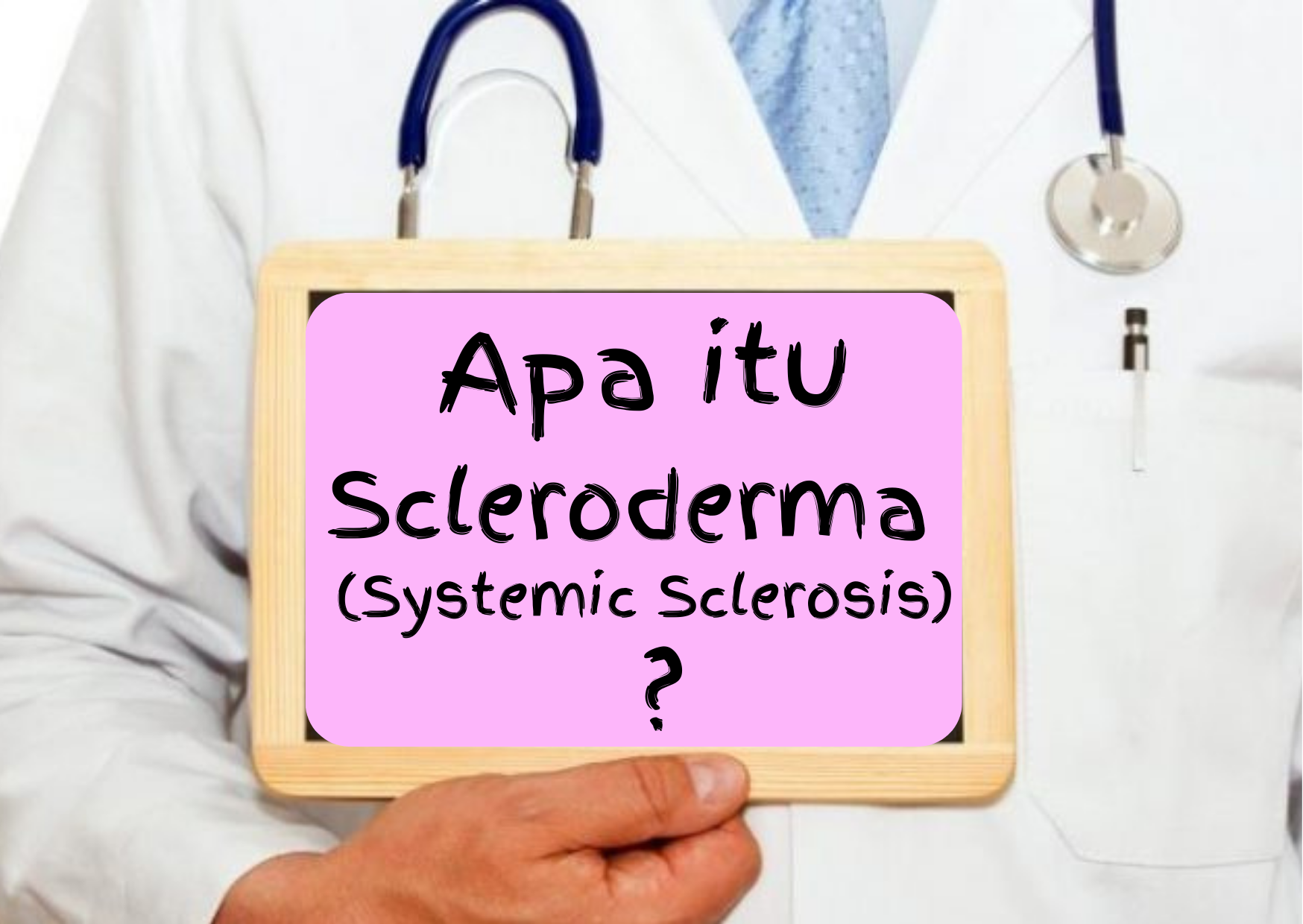 Apa itu Scleroderma (Systemic Sclerosis) ?